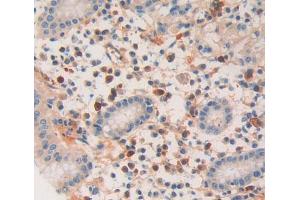 Used in DAB staining on fromalin fixed paraffin- embedded Kidney tissue (DNAJC2 antibody  (AA 442-621))