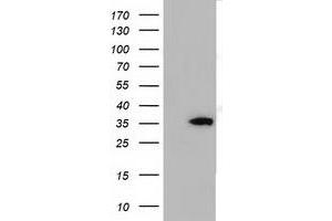Western Blotting (WB) image for anti-Short Chain Dehydrogenase/reductase Family 9C, Member 7 (SDR9C7) antibody (ABIN1500845)