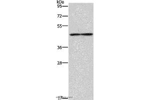 Western blot analysis of Mouse heart tissue, using IL5RA Polyclonal Antibody at dilution of 1:550 (IL5RA antibody)