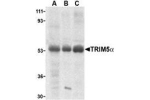 Western blot analysis of TRIM5 alpha expression in human stomach (A), thymus (B), and uterus (C) cell lysate with this product at 2 μg /ml.