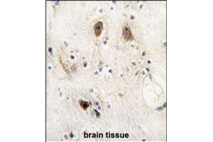 Formalin-fixed and paraffin-embedded human brain tissue reacted with ROR2 antibody, which was peroxidase-conjugated to the secondary antibody, followed by DAB staining. (ROR2 antibody)