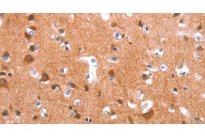 Immunohistochemistry of paraffin-embedded Human brain tissue using GAS8 Polyclonal Antibody at dilution 1:40 (GAS8 antibody)