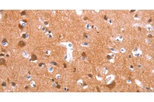 Immunohistochemistry of paraffin-embedded Human brain tissue using GAS8 Polyclonal Antibody at dilution 1:40