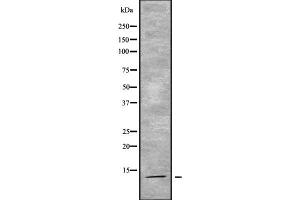 Western blot analysis of ACYP2 using K562 whole cell lysates (Acyp2 antibody  (Internal Region))