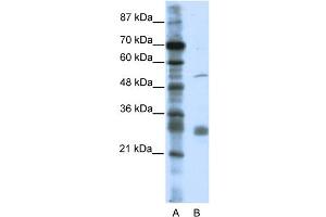 WB Suggested Anti-LRRC14 Antibody Titration:  0.