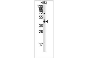 Image no. 1 for anti-BCL2-Like 14 (Apoptosis Facilitator) (BCL2L14) (BH3 Domain), (Isoform 3) antibody (ABIN356813) (BCL2L14 antibody  (BH3 Domain, Isoform 3))