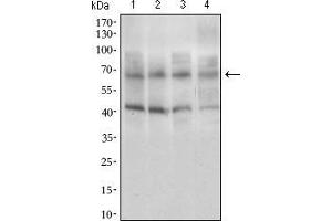 Western blot analysis using ABCG5 mouse mAb against HepG2 (1), HeLa (2), Jurkat (3), and Lovo (4) cell lysate. (ABCG5 antibody  (AA 306-367))