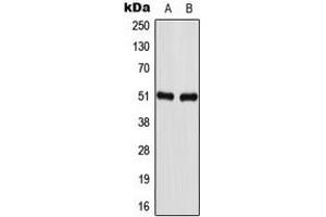 Western blot analysis of GABRA1 expression in U87MG (A), NIH3T3 (B) whole cell lysates. (GABRA1 antibody  (Center))