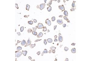 anti-CD276 (CD276) (AA 29-465) antibody