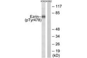 Image no. 1 for anti-Ezrin (EZR) (AA 446-495), (pTyr478) antibody (ABIN1532010) (Ezrin antibody  (pTyr478))