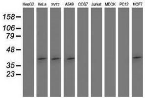 Image no. 2 for anti-SET Domain Containing (Lysine Methyltransferase) 7 (SETD7) antibody (ABIN1500903) (SETD7 antibody)