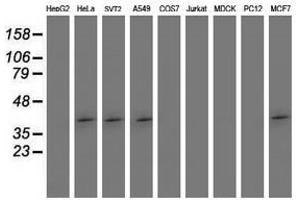 Image no. 2 for anti-SET Domain Containing (Lysine Methyltransferase) 7 (SETD7) antibody (ABIN1500903) (SETD7 antibody)