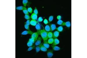 anti-Peptidylprolyl Isomerase D (PPID) (AA 306-370) antibody