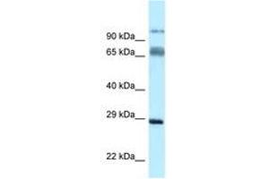Image no. 1 for anti-Proline Rich Transmembrane Protein 1 (PRRT1) (N-Term) antibody (ABIN6747874) (PRRT1 antibody  (N-Term))