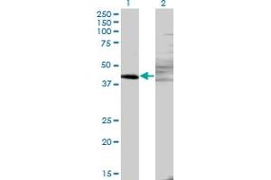 Western Blot analysis of ZNF193 expression in transfected 293T cell line by ZNF193 monoclonal antibody (M06), clone 3G6. (Zinc Finger and SCAN Domain Containing 9 (ZSCAN9) (AA 1-90) antibody)