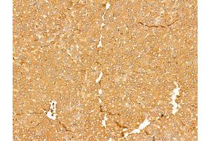 ABIN7094734 and ABIN7098785 at 1/100 staining Rat liver tissue by IHC-P. (ALDH9A1 antibody  (C-Term))