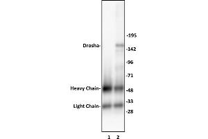 Immunoprecipitation (IP) image for anti-Drosha, Ribonuclease Type III (DROSHA) (C-Term) antibody (ABIN6971610)