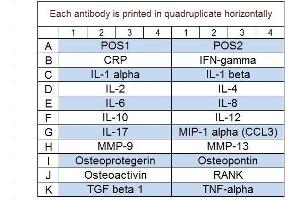 Image no. 1 for Human Periodontal Disease Array Q1 (ABIN4956067) (Human Periodontal Disease Array Q1)