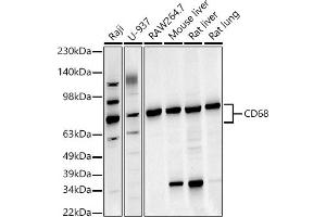 Western blot analysis of extracts of various cell lines, using CD68 antibody (ABIN6132070, ABIN6138218, ABIN6138221 and ABIN6217224) at 1:1000 dilution. (CD68 antibody  (AA 22-319))
