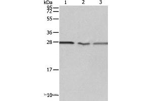 Western blot analysis of Jurkat, A549 cell and Human fetal kidney tissue, using PSMD9 Polyclonal Antibody at dilution of 1:750