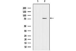 Western blot analysis of lysates from Myeloma cells, using TBRG4 Antibody.