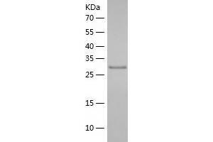 Western Blotting (WB) image for Sulfotransferase Family, Cytosolic, 2A, Dehydroepiandrosterone (DHEA)-Preferring, Member 1 (SULT2A1) (AA 1-285) protein (His tag) (ABIN7125239) (SULT2A1 Protein (AA 1-285) (His tag))