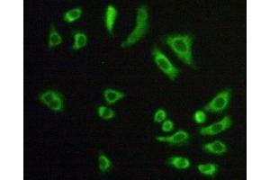 Detection of CS in Hela cells using Polyclonal Antibody to Citrate Synthase (CS) (CS antibody  (AA 56-312))