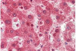 Human Liver: Formalin-Fixed, Paraffin-Embedded (FFPE) (Zinc Finger Protein 296 (ZNF296) (AA 300-349) antibody)
