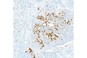 Immunohistochemistry (IHC) image for anti-S100 Calcium Binding Protein A9 (S100A9) (AA 64-114) antibody (ABIN7449432) (Recombinant S100A9 antibody  (AA 64-114))