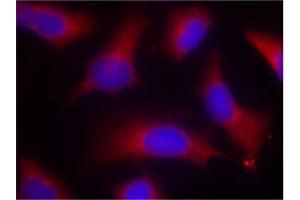 Image no. 3 for anti-Microtubule-Associated Protein tau (MAPT) (pSer262) antibody (ABIN196808) (MAPT antibody  (pSer262))