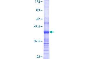 Supervillin Protein (SVIL) (AA 1679-1786) (GST tag)