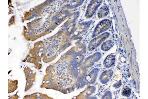 IHC analysis of PON1 using anti-PON1 antibody . (PON1 antibody  (AA 30-274))