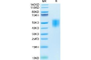 Growth Hormone Receptor Protein (GHR) (AA 27-264) (His tag)