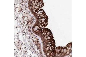 Immunohistochemical staining of human nasopharynx with TMEM111 polyclonal antibody  shows strong cytoplasmic and membranous positivity in respiratory epithelial cells at 1:50-1:200 dilution. (EMC3 antibody)