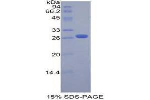 SDS-PAGE (SDS) image for Fibroblast Growth Factor Receptor-Like 1 (FGFRL1) (AA 164-374) protein (His tag) (ABIN1878470)