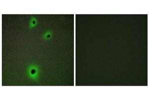 Immunofluorescence (IF) image for anti-Cell Adhesion Molecule 4 (CADM4) (C-Term) antibody (ABIN1850236) (Cell Adhesion Molecule 4 antibody  (C-Term))