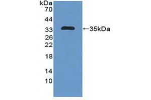 Detection of Recombinant MAP1B, Human using Polyclonal Antibody to Microtubule Associated Protein 1B (MAP1B) (MAP1B antibody  (AA 2207-2468))