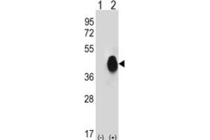 Western Blotting (WB) image for anti-CD38 antibody (ABIN3001687)