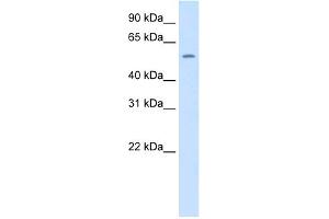 WB Suggested Anti-Thrb Antibody Titration:  1. (THRB antibody  (N-Term))