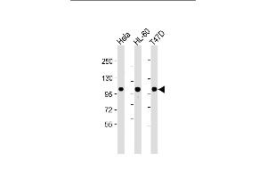 All lanes : Anti-EZH2 Antibody at 1:2000 dilution Lane 1: Hela whole cell lysate Lane 2: HL-60 whole cell lysate Lane 3: T47D whole cell lysate Lysates/proteins at 20 μg per lane. (EZH2 antibody)