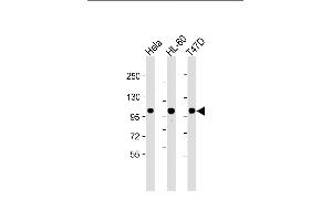 EZH2 antibody