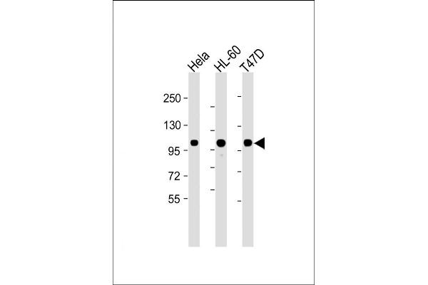 EZH2 antibody