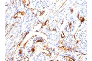 Immunohistochemistry (IHC) image for anti-beta-2-Microglobulin (B2M) antibody (ABIN6940411)