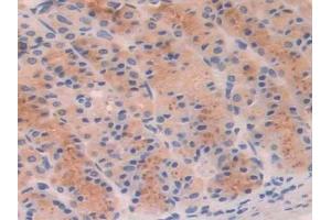 DAB staining on IHC-P; Samples: Rat Stomach Tissue (PFKP antibody  (AA 354-570))