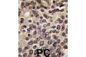 Immunohistochemistry (IHC) image for anti-PKN beta antibody (ABIN3003586) (PKN beta antibody)