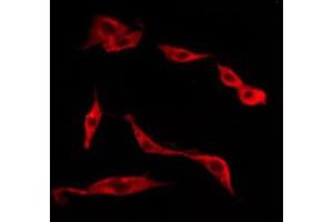 ABIN6277647 staining Hela by IF/ICC. (TACR1 antibody  (Internal Region))