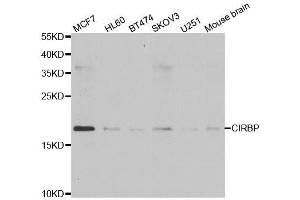 Western blot analysis of extracts of various cell lines, using CIRBP antibody.