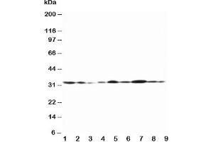 Western blot testing of Connexin 32 antibody and Lane 1:  rat heart;  2: rat heart;  3: rat skeletal muscle;  4: rat brain;  5: MCF-7;  6: HeLa;  7: SMMC-7721;  8: Jurkat;  9: COLO320