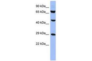 Image no. 1 for anti-Small Nuclear Ribonucleoprotein Polypeptides B and B1 (SNRPB) (AA 35-84) antibody (ABIN6742979) (SNRPB antibody  (AA 35-84))