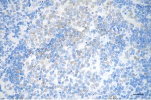 Immunohistochemistry was performed on paraffin-embedded human tonsillitis using DNA methyltransferase 1 antibody (ABIN7798362), 1:200). (Recombinant DNMT1 antibody)